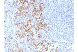 Formalin-fixed, paraffin-embedded human Spleen stained with CD162 Monoclonal Antibody (PSGL1/1601). (SELPLG Antikörper)