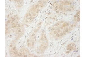 Immunohistochemistry (IHC) image for anti-Spleen tyrosine Kinase (SYK) (AA 250-300) antibody (ABIN7448821)