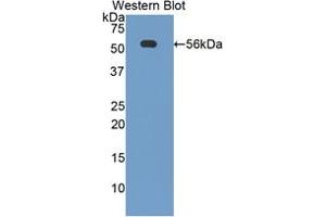 Western blot analysis of the recombinant protein. (CD46 Antikörper  (AA 157-365))