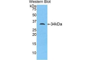 Western Blotting (WB) image for anti-Myosin ID (MYO1D) (AA 581-847) antibody (ABIN1078392)