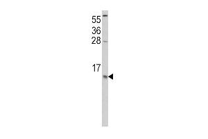 CCL2 Antikörper  (C-Term)