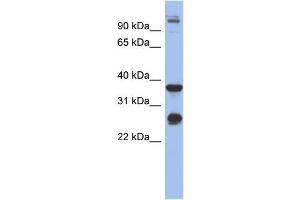 WB Suggested Anti-BGN Antibody Titration: 0. (Biglycan Antikörper  (Middle Region))