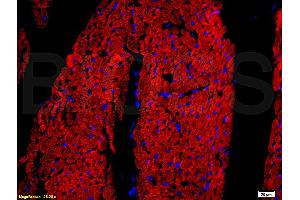 Formalin-fixed and paraffin embedded rat heart tissue labeled with Rabbit Anti-DOG-1/TMEM16A Polyclonal Antibody, Unconjugated (ABIN704216) at 1:200 followed by conjugation to the secondary antibody and DAB staining. (ANO1 Antikörper  (AA 151-250))
