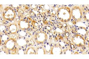 Detection of ORM2 in Human Kidney Tissue using Polyclonal Antibody to Orosomucoid 2 (ORM2)