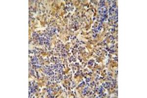 Immunohistochemistry (Paraffin-embedded Sections) (IHC (p)) image for anti-Inhibitor of Bruton Agammaglobulinemia Tyrosine Kinase (IBTK) (AA 589-617), (Middle Region) antibody (ABIN952814)