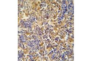 Immunohistochemistry analysis in formalin fixed and paraffin embedded human lymph tissue reacted with IBTK / BTKI Antibody (Center) followed which was peroxidase conjugated to the secondary antibody and followed by DAB staining. (IBTK Antikörper  (Middle Region))
