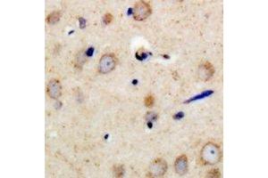 Immunohistochemical analysis of PSMD11 staining in human brain formalin fixed paraffin embedded tissue section.