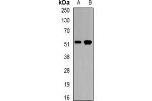 Western blot analysis of CALCOCO2 expression in mouse pancreas (A), rat skeletal muscle (B) whole cell lysates. (CALCOCO2 Antikörper)