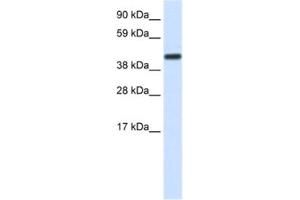 Western Blotting (WB) image for anti-CCR4-NOT Transcription Complex, Subunit 2 (CNOT2) antibody (ABIN2460364)