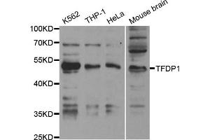 Western Blotting (WB) image for anti-Transcription Factor Dp-1 (TFDP1) antibody (ABIN1876610) (DP1 Antikörper)