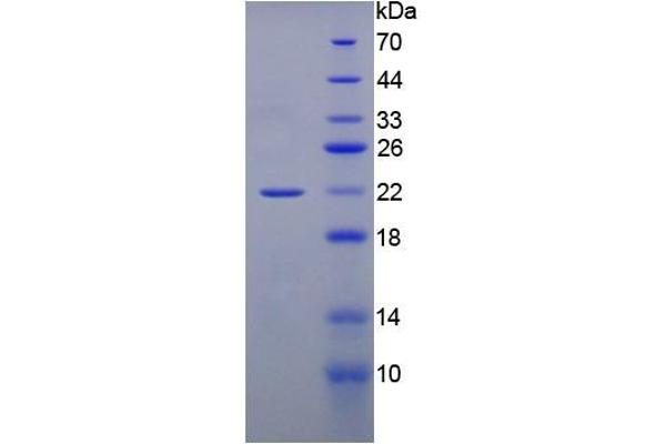 GREM1 Protein