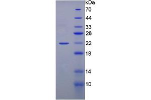 SDS-PAGE analysis of active recombinant Rat GREM1. (GREM1 Protein)