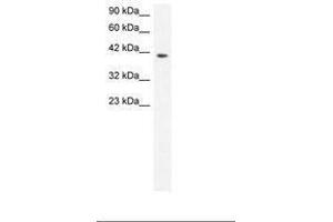 Image no. 3 for anti-Matrix Metallopeptidase 19 (MMP19) (AA 56-105) antibody (ABIN6735807)