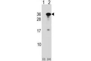 Western Blotting (WB) image for anti-RING1 and YY1 Binding Protein (RYBP) antibody (ABIN2998877) (RYBP Antikörper)