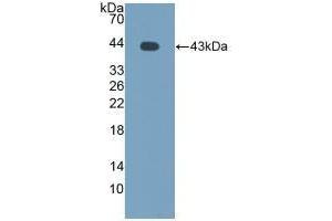 Detection of Recombinant MCP2, Bovine using Polyclonal Antibody to Monocyte Chemotactic Protein 2 (MCP2) (CCL8 Antikörper  (AA 1-99))