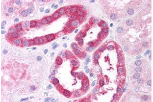 Human Renal Tubular Epithelium (formalin-fixed, paraffin-embedded) stained with RICTOR antibody ABIN297558 at 2. (RICTOR Antikörper  (AA 1722-1732))