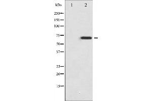 Western blot analysis of Merlin phosphorylation expression in IFN-α treated HuvEc whole cell lysates,The lane on the left is treated with the antigen-specific peptide. (Merlin Antikörper  (pSer518))