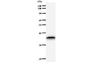 Western Blotting (WB) image for anti-Ubinuclein 1 (UBN1) antibody (ABIN930942) (Ubinuclein 1 Antikörper)