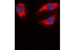Immunofluorescent analysis of Synapsin 1 staining in MCF7 cells.