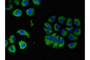Immunofluorescent analysis of A549 cells using ABIN7160353 at dilution of 1:100 and Alexa Fluor 488-congugated AffiniPure Goat Anti-Rabbit IgG(H+L) (CHRM5 Antikörper  (AA 220-427))