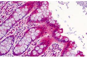 Human Colon: Formalin-Fixed, Paraffin-Embedded (FFPE) (SLFN12 Antikörper  (C-Term))