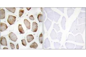 Immunohistochemistry analysis of paraffin-embedded human skeletal muscle tissue, using DUS2L Antibody. (DUSL2 Antikörper  (AA 421-470))