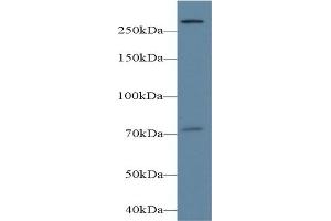 Detection of PLCe1 in Mouse Cerebrum lysate using Polyclonal Antibody to Phospholipase C Epsilon 1 (PLCe1) (PLCE1 Antikörper  (AA 1-250))
