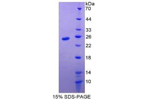 SDS-PAGE (SDS) image for Baculoviral IAP Repeat-Containing 5 (BIRC5) (AA 1-140) protein (His tag) (ABIN1879259)
