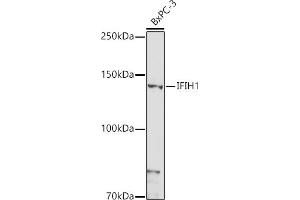 Western blot analysis of extracts of BxPC-3 cells, using IFIH1 antibody (ABIN6131879, ABIN6142174, ABIN6142175 and ABIN6217724) at 1:1000 dilution. (IFIH1 Antikörper  (AA 1-205))