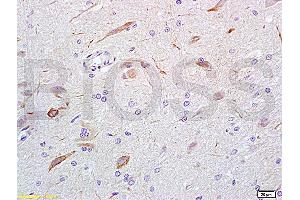 Formalin-fixed and rat brain tissue labeled with Anti-GABA Polyclonal Antibody, Unconjugated (ABIN679013) at 1:200 followed by conjugation to the secondary antibody and DAB staining (GABA Antikörper)
