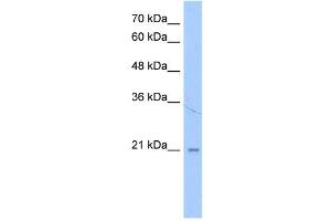 LOC728864 antibody used at 1 ug/ml to detect target protein. (LOC728864 (N-Term) Antikörper)