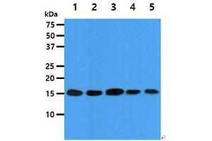 The cell lysates (40ug) were resolved by SDS-PAGE, transferred to PVDF membrane and probed with anti-human EIF5A antibody (1:1000). (EIF5A Antikörper)