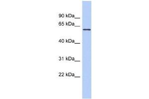 PDE4B antibody used at 1 ug/ml to detect target protein. (PDE4B Antikörper)