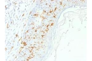 IHC testing of FFPE human skin with CD1a antibody. (CD1a Antikörper)