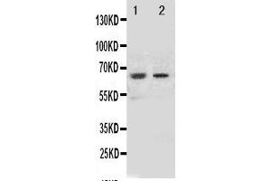 Anti-NOX1 antibody, Western blottingAll lanes: Anti NOX1  at 0.