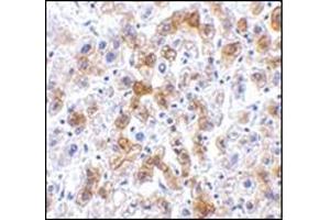 Immunohistochemistry of SCO2 in human liver tissue with this product at 2. (SCO2 Antikörper  (C-Term))