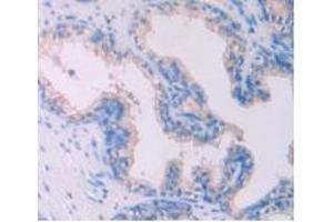 IHC-P analysis of Human Prostate Gland Tissue, with DAB staining. (IL-4 Antikörper  (AA 25-153))