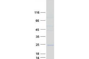 Western Blotting (WB) image for ADP Ribosylation Factor Like GTPase 1 (ARL1) protein (Myc-DYKDDDDK Tag) (ABIN2714901)