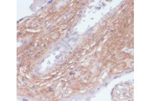 Immunohistochemistry of paraffin-embedded Human placenta using COL1A1 Polyclonal Antibody at dilution of 1:200 (40x lens). (COL1A1 Antikörper)