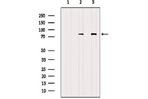 Western Blotting (WB) image for anti-Adducin 1 (Alpha) (ADD1) antibody (ABIN6259794)