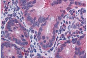 Mouse Small Intestine: Formalin-Fixed, Paraffin-Embedded (FFPE) (IL-10 Antikörper)
