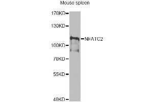 Western blot analysis of extracts of mouse spleen, using NFATC2 antibody (ABIN6292207) at 1:1000 dilution. (NFAT1 Antikörper)