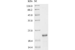 (Tris-Glycine gel) Discontinuous SDS-PAGE (reduced) with 5 % enrichment gel and 15 % separation gel.