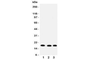 Western blot testing of UBC9 antibody and rat samples 1: heart (UBE2I Antikörper  (C-Term))