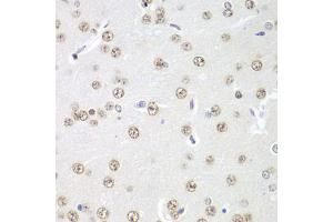 Immunohistochemistry of paraffin-embedded rat brain using PRMT5 antibody. (PRMT5 Antikörper)