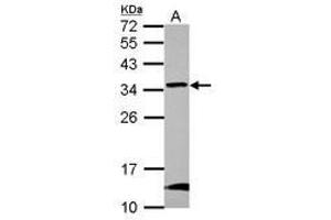 Image no. 1 for anti-Glioblastoma Amplified Sequence (GBAS) (AA 77-265) antibody (ABIN1498393) (GBAS Antikörper  (AA 77-265))