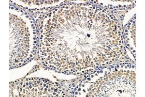 ABIN7096401 and ABIN7100465 at 1/100 staining rat testis tissue by IHC-P. (SPEF1 Antikörper)