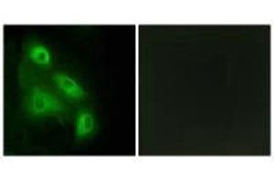 Immunofluorescence analysis of HeLa cells, using ES8L3 antibody. (EPS8-Like 3 Antikörper)