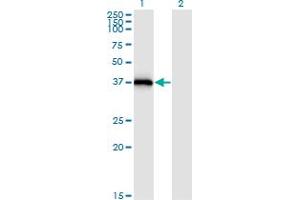 Western Blot analysis of STX16 expression in transfected 293T cell line by STX16 monoclonal antibody (M03), clone 3D12. (Syntaxin 16 Antikörper  (AA 1-99))