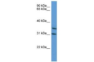 WB Suggested Anti-MAPKAPK3 Antibody Titration: 0. (MAPKAP Kinase 3 Antikörper  (C-Term))